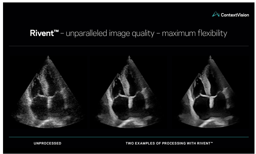 ̩ӰContextVisionl(f)ߴ2DD(qing)ܛRivent¶xD(qing)
