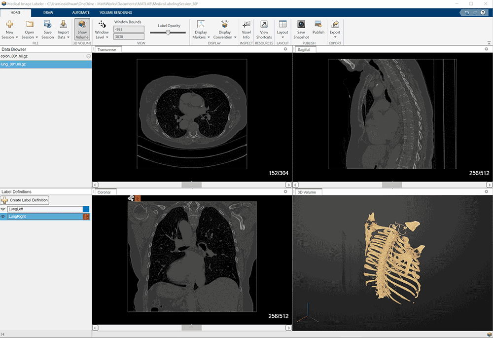 MATLABSimulink R2022bṩȫµSimscape BatteryԼ£Ԅ(dng)ģ͵O(sh)Ӌ(j)